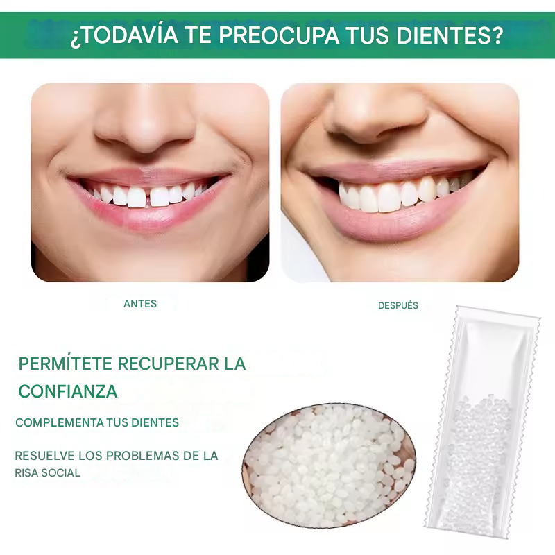 Perfect-Smile™ - Dientes postizos temporales