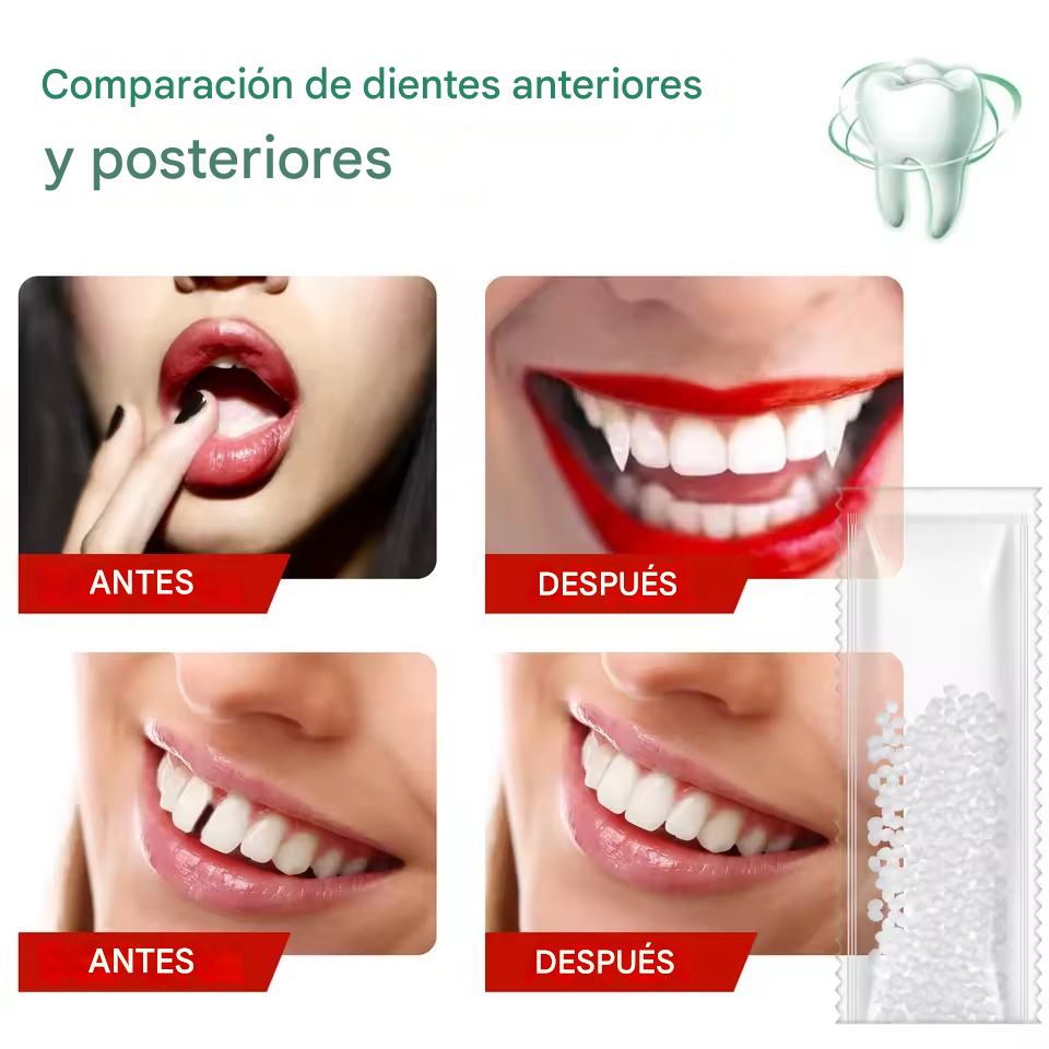 Perfect-Smile™ - Dientes postizos temporales